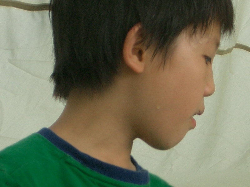 Original image
