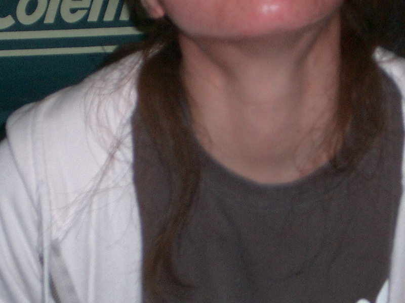 Original image